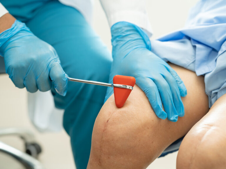 Dowiedz się, jak wygląda artroskopia kolana – minimalnie inwazyjny zabieg ortopedyczny. Zobacz zdjęcie ilustrujące procedurę oraz przeczytaj szczegóły dotyczące diagnostyki i leczenia stawu kolanowego.