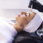 Zabieg peelingu chemicznego wykonywany w gabinecie medycyny estetycznej dla poprawy kondycji skóry.