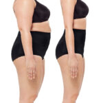 Plastyka brzucha (abdominoplastyka) – wskazania, przebieg operacji i efekty zabiegu poprawiającego sylwetkę. Chirurgia plastyczna Wrocław.