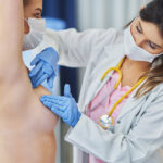 Rekonstrukcja piersi po mastektomii – obraz przedstawiający efekty odbudowy piersi z wykorzystaniem nowoczesnych metod chirurgicznych.