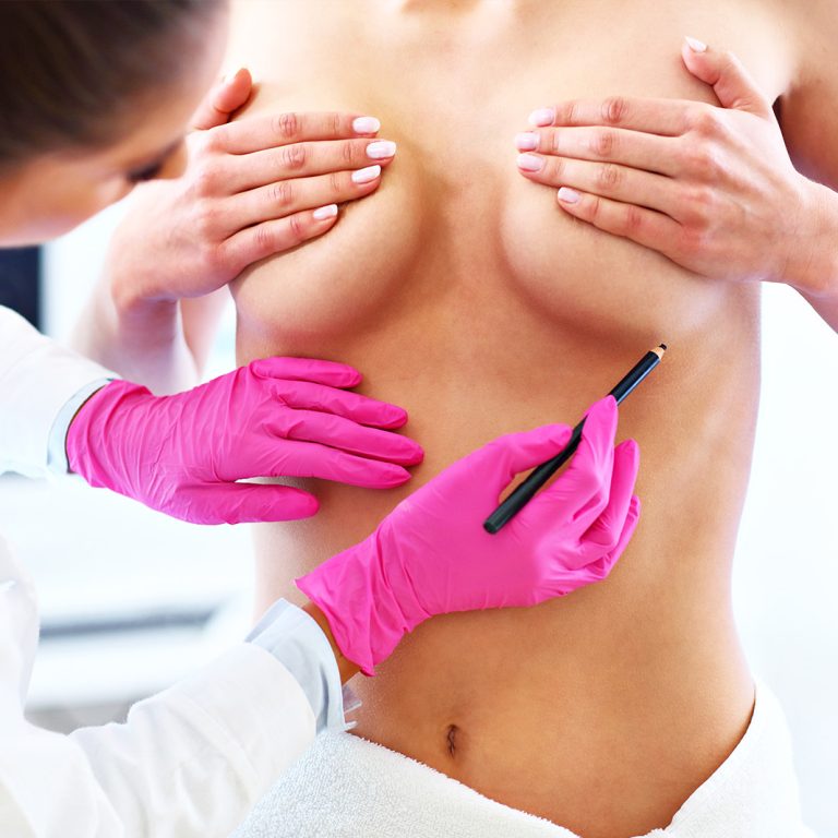 chirurgia-plastyczna-wroclaw-lifting-piersi-1