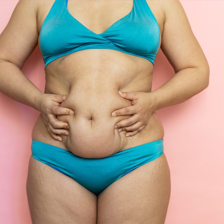 chirurgia-plastyczna-wroclaw-liposukcja-odsysanie-tluszczu-1