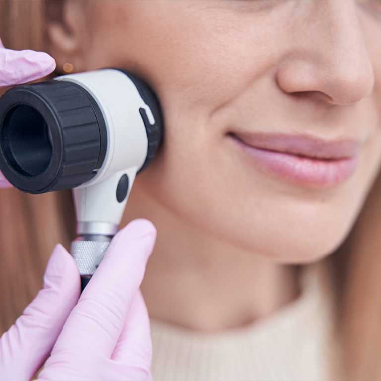 dermatologia-wroclaw-dermatoskopia-ocena-znamion-1