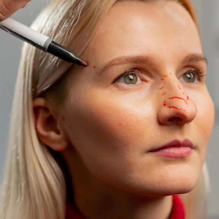 Plastyka nosa wspierająca funkcje zdrowotne – poprawa przegrody nosowej, oddychania i redukcja chrapania. Chirurgia plastyczna Wrocław.