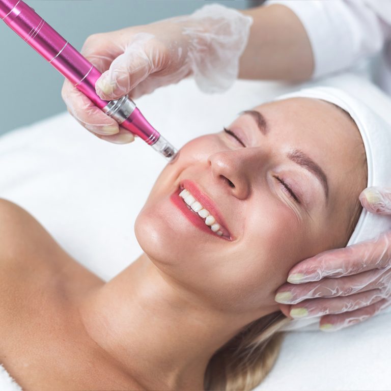 medycyna-estetyczna-wroclaw-dermapen-1