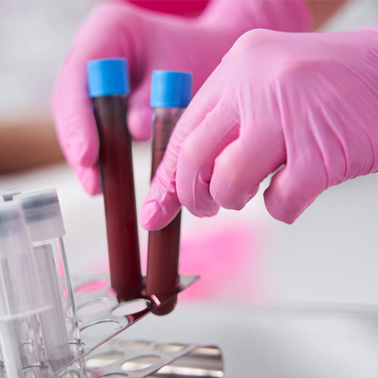 ortopedia-wroclaw-osocze-bogatoplytkowe-1