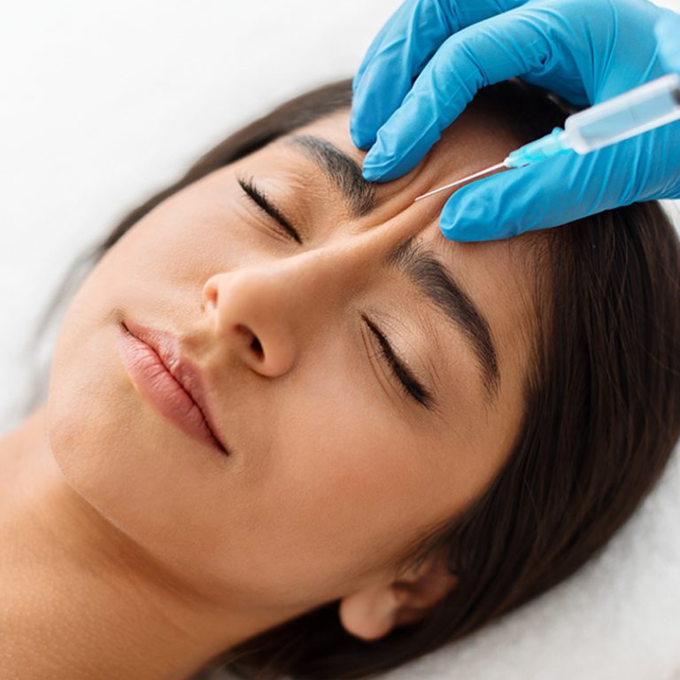 Zdjęcie przedstawia zabieg z wykorzystaniem toksyn botulinowych, który skutecznie redukuje zmarszczki mimiczne i poprawia estetykę skóry.